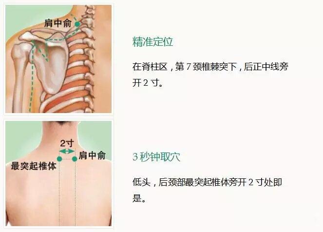 肩中俞的准确位置图片图片